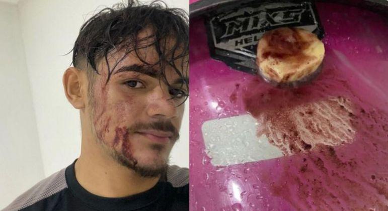 entregador-tem-acai-jogado-na-cara-por-cliente-na-paraiba-28022023111039280