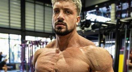 fisiculturista-aneurisma-03072023140142166