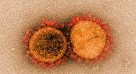 sars-cov-2-22062021160552451