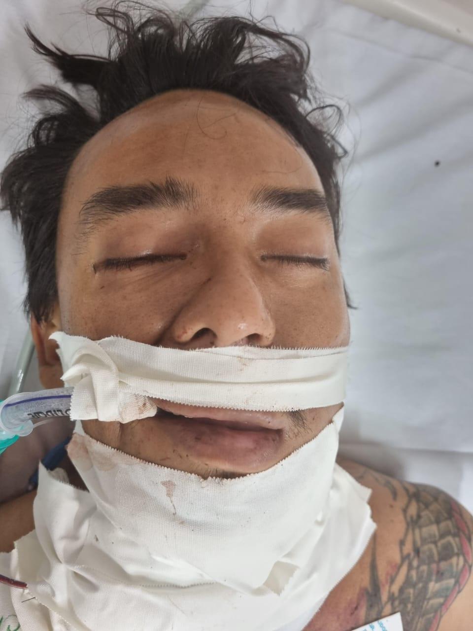 SES-AM.02_Paciente-internado-sem-acompanhante-ou-familiares_