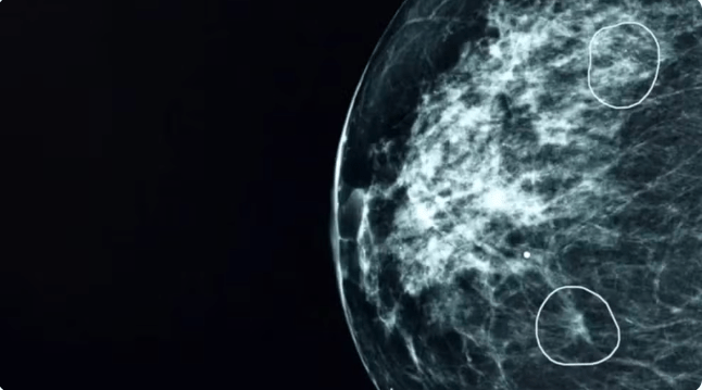 Captura de tela 2024-03-24 062426