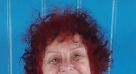 escritora-roseana-murray-ataque-pitbull-05042024133747162