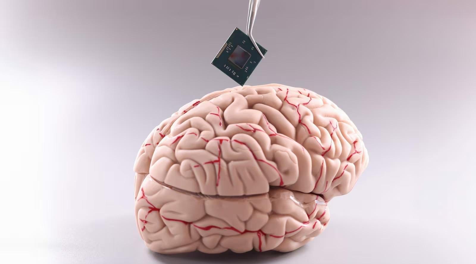 cerebro