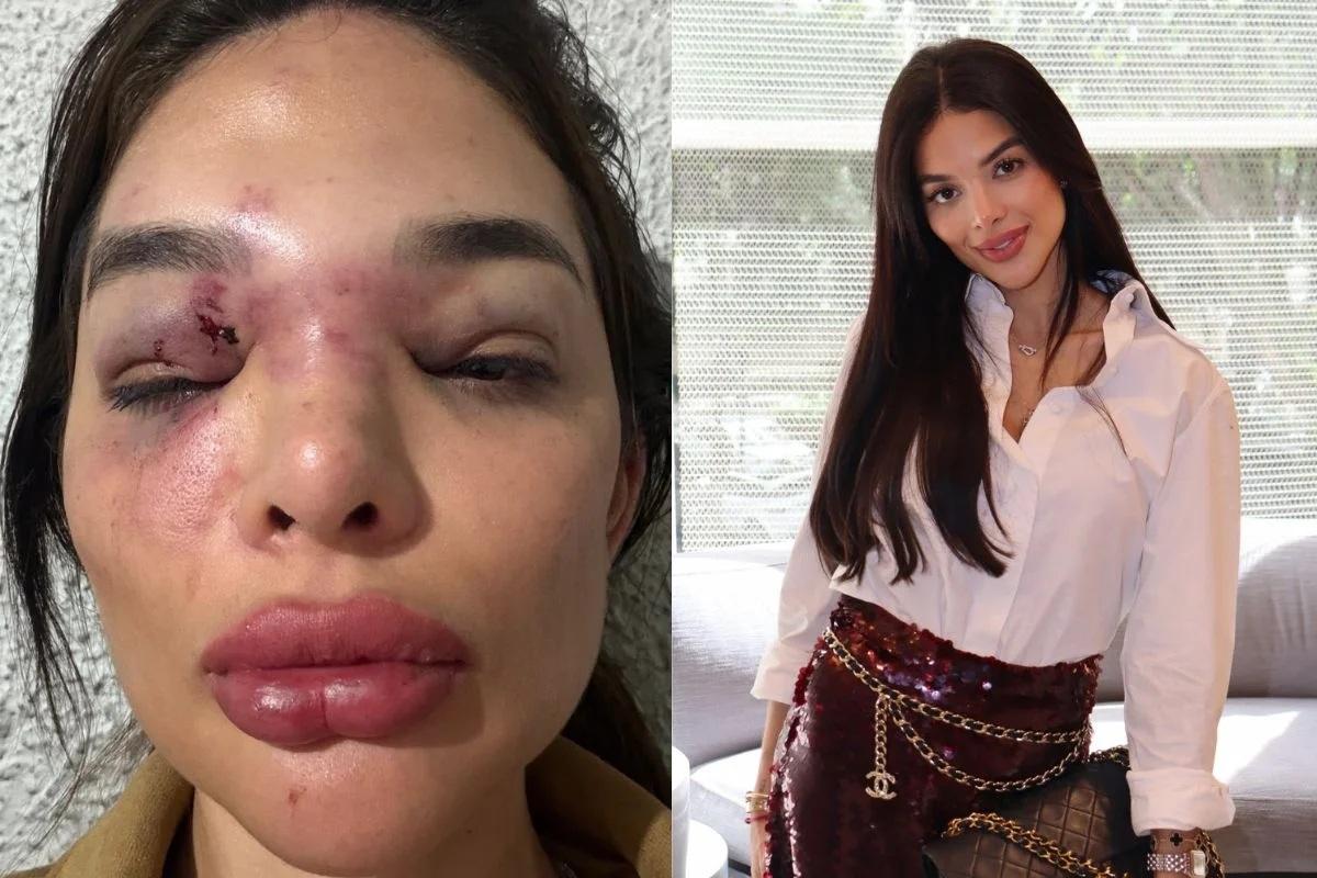 dentista agredida
